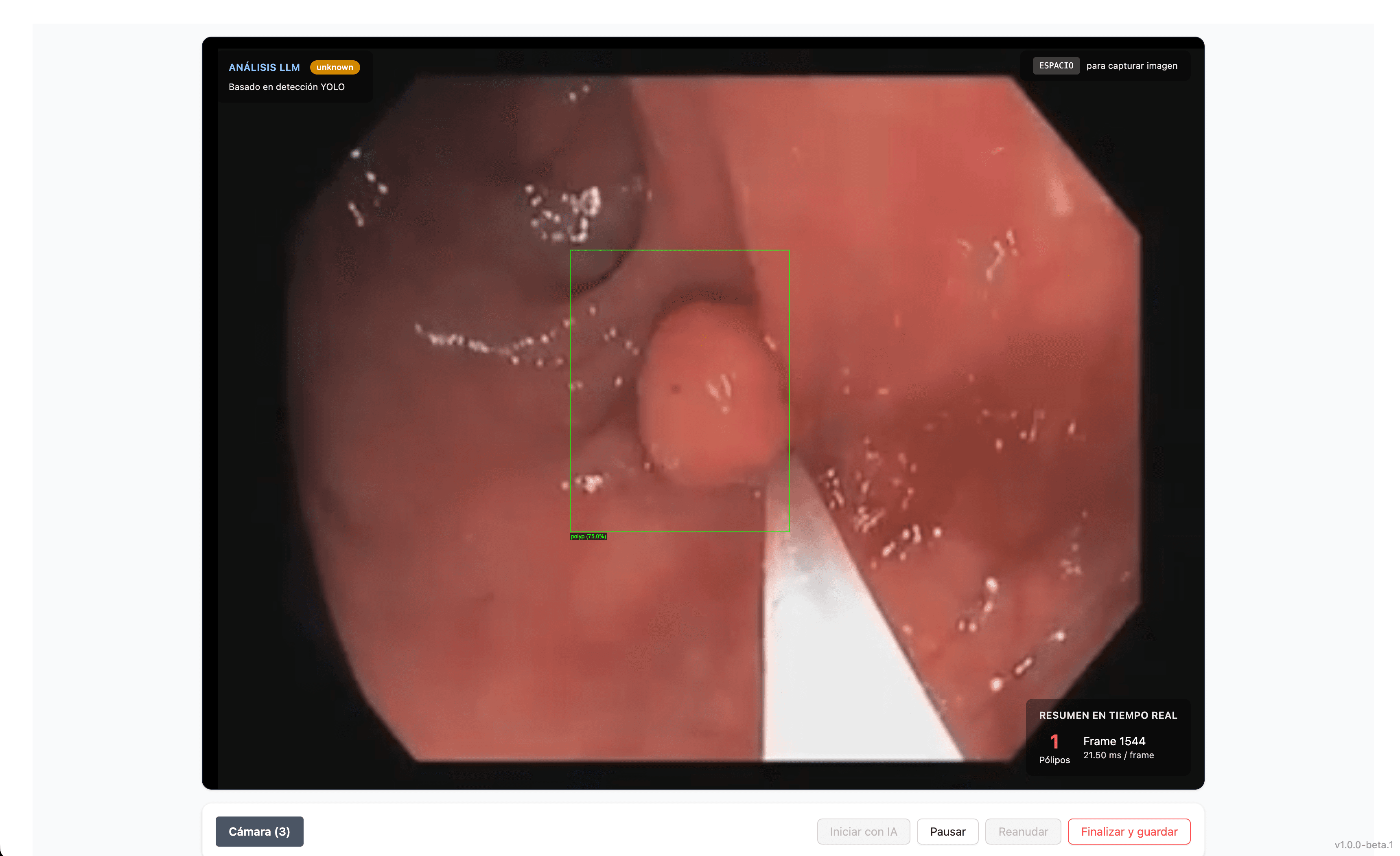 ADVANCE — Detección Médica Asistida por IA